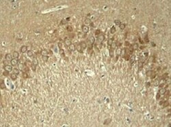 Tau, p Thr181 Antibody, Novus Biologicals:Antibodies:Primary Antibodies